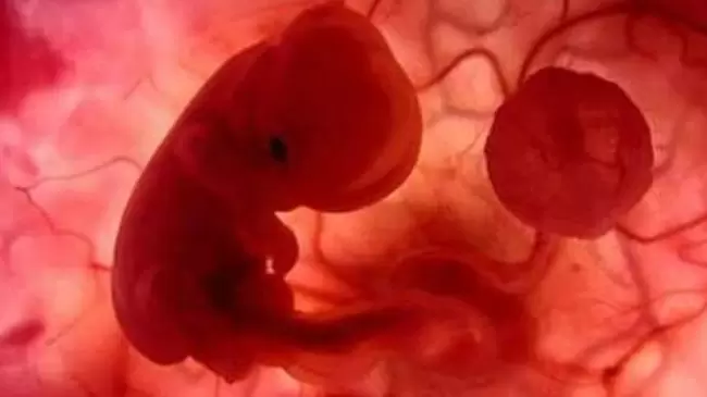 aborto_no