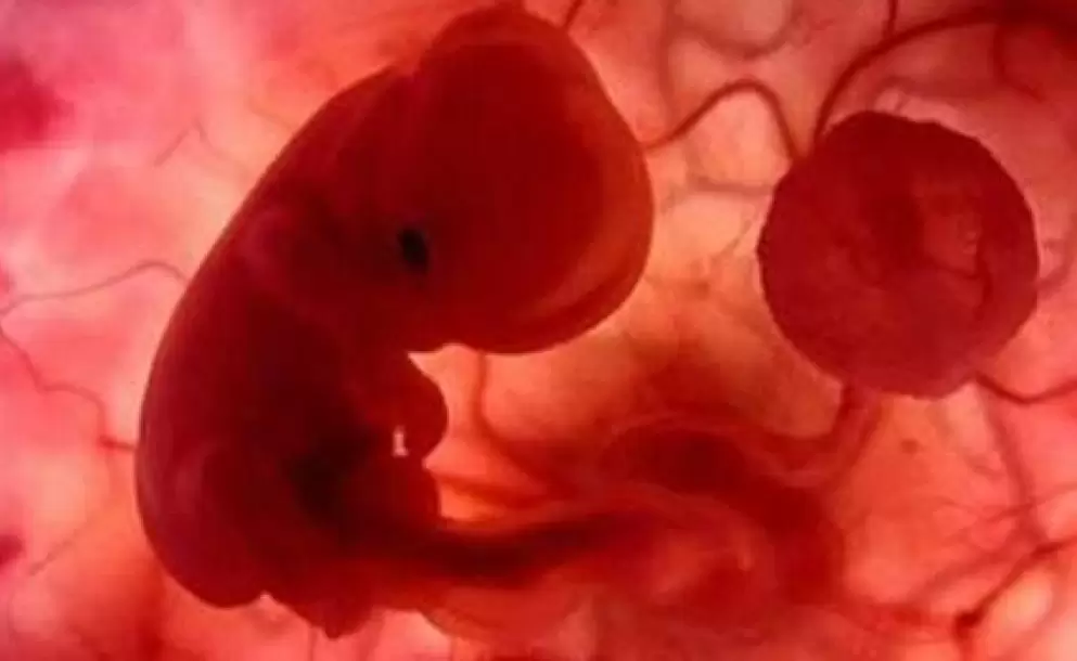 aborto_no