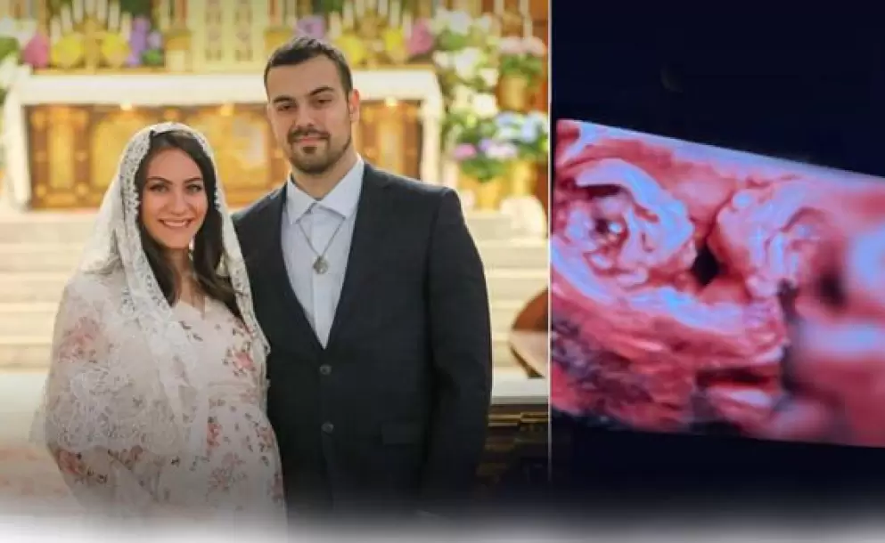 ¿Te unes a rezar por sus hijos y por ella? Se negó al aborto y dará a luz a gemelos unidos con un mismo corazón