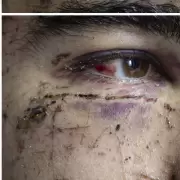 brutal ataque a joven