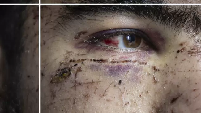 brutal ataque a joven