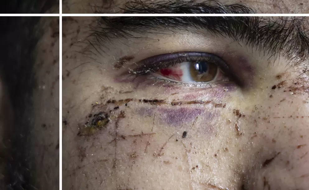 brutal ataque a joven